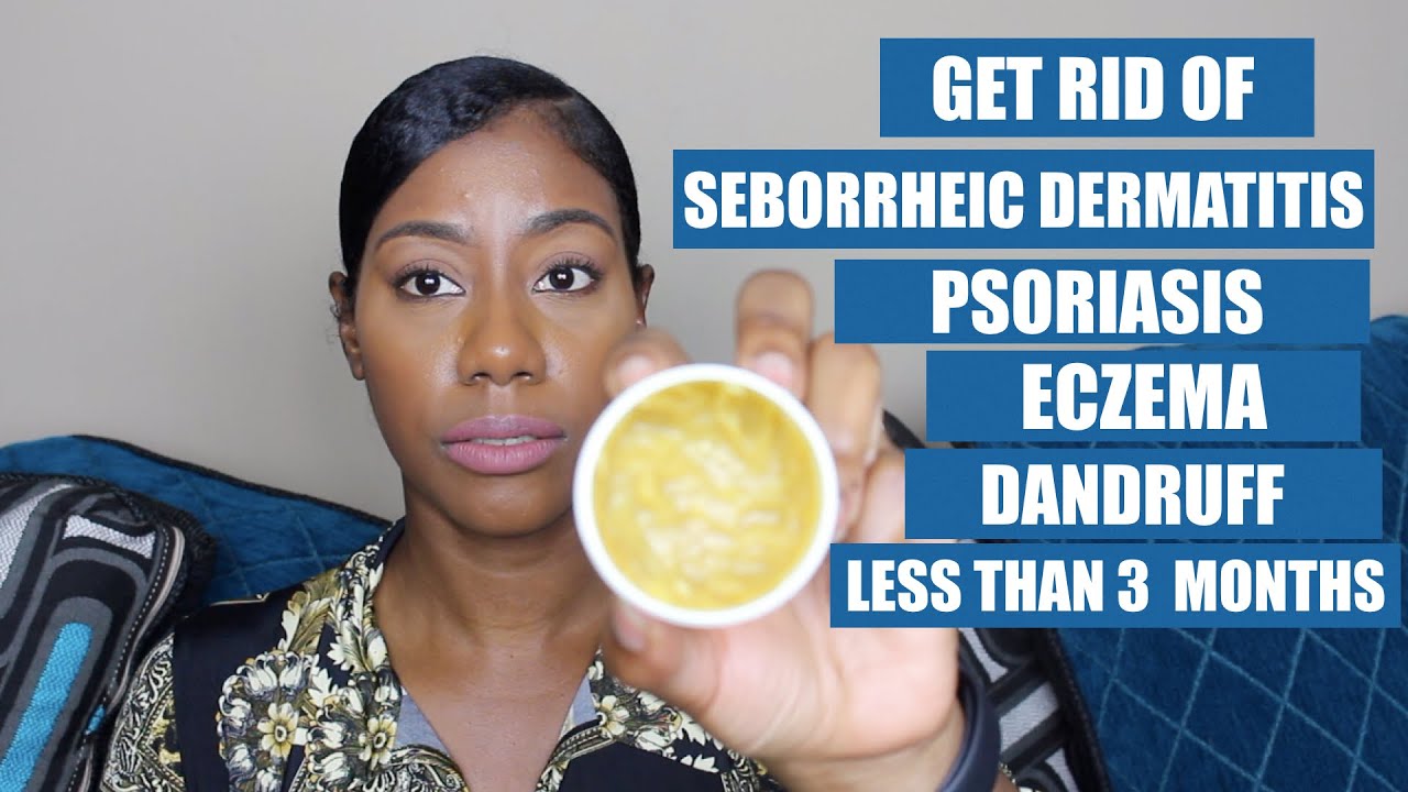 How to get rid of seborrheic dermatitis, psoriasis, dandruff less than