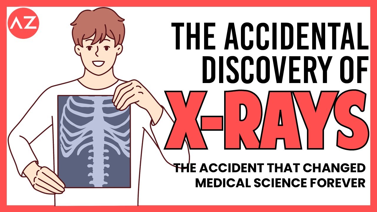 XRay Discovery The Accident That Changed Medical Science Forever