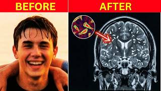 A Boy Jumped In A Lake. 6 Days Later, His Brain Was Gone.