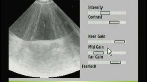 Cell Phone Ultrasound Machine: Demo 1