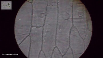 onion cells under microscope