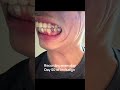 day50