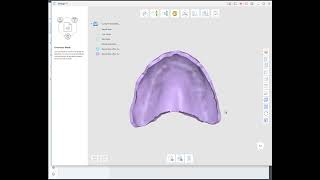 How to create a Custom Tray in Medit Design