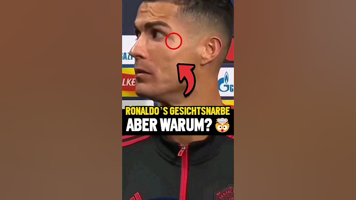 Wunde auf Ronaldos Gesicht – Warum? 🤯😱 #shorts #Fußball #Ronaldo