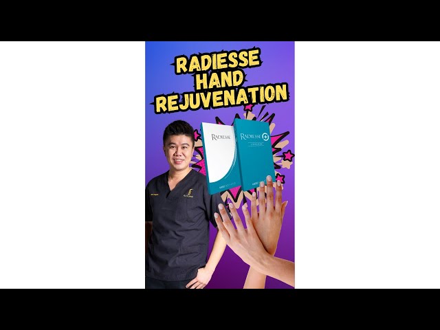 Youthful Hands with Radiesse Hand Rejuvenation Explained! class=