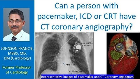 Can a person with pacemaker, ICD or CRT have CT coronary angiography?