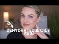 DEHYDRATED & OILY ?? Let's talk about it