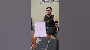 COAPT Pattern Recognition training with TMR IDF Trans-humeral Amputee #prostheticinnovations #TMR