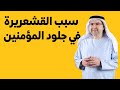 ما سبب القشعريرة التي تصيب الانسان سمعها