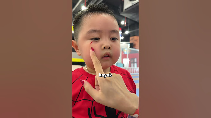 Kaget tiba2 Clayton ngampirin kita udah luka gitu 🥲