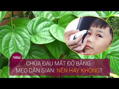 Video: Làm Gì Nếu Trẻ Bị đau Mắt đỏ