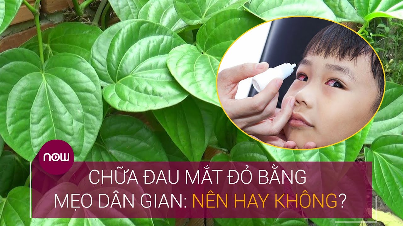 Những điều "tối kỵ" khi bị đau mắt đỏ | VTC Now