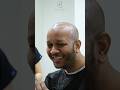Hair Transplant Steps in Turkey - #hairtransplantturkey #hairtransplant