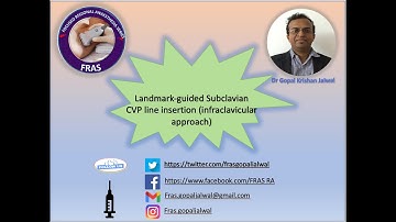 Landmark-guided subclavian CVP line insertion (Infraclavicular approach)