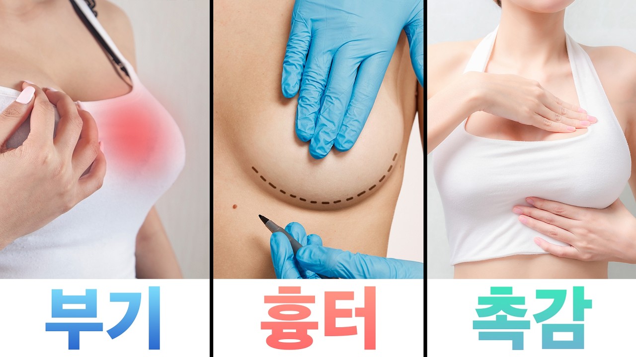 "가슴 수술 후 양쪽 붓기가 달라요" 짝가슴 될까 봐 불안한 분들 꼭 보세요! (부기·흉터·촉감 총정리)
