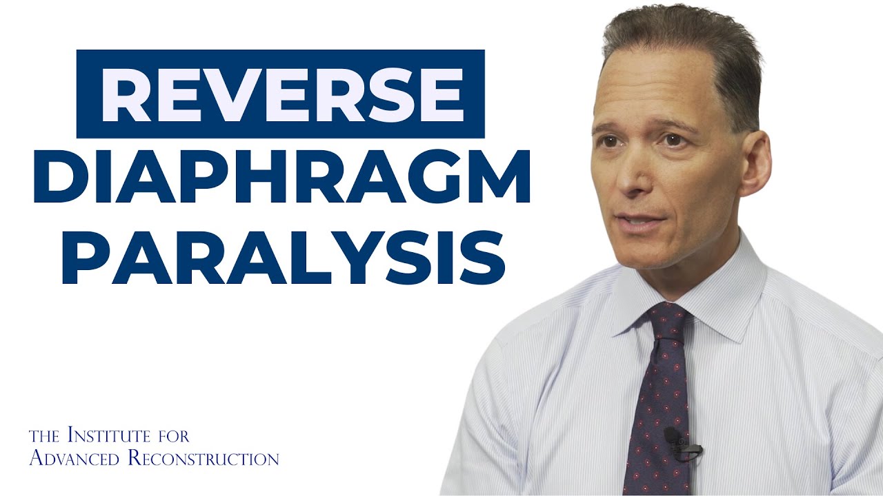 Diaphragm Paralysis Understanding Symptoms, Diagnosis, and Treatment