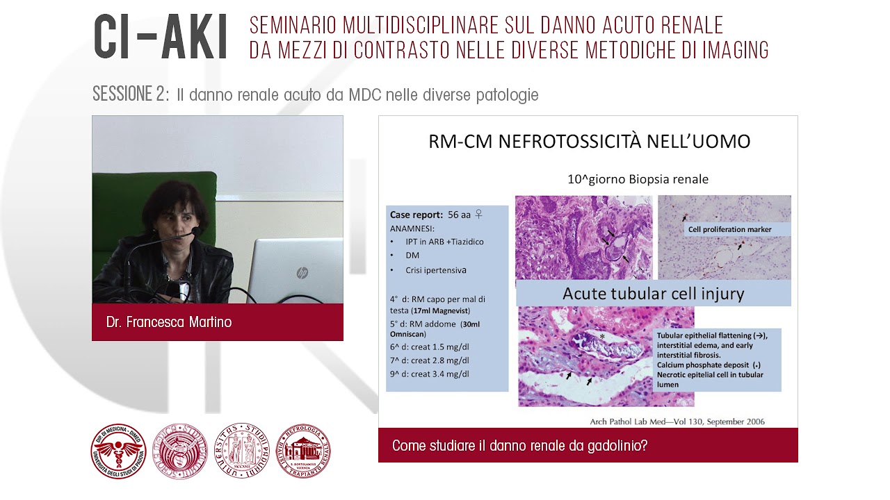 Martino - Come Studiare il Danno Renale da Gadolinio?