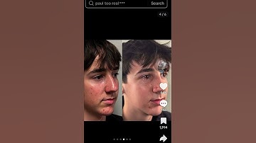 Paul too reals nose job 😭#shorts #fyp 