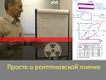 Просто о рентгеновской пленке