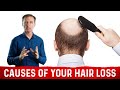 The Underlying Root Cause Of Hair Loss - Treatment For Hair Loss Dr.Berg