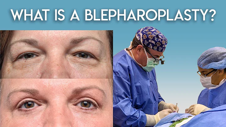 What is a Blepharoplasty?
