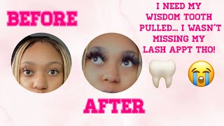 I got lash extensions with a painful wisdom tooth ?