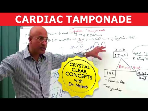 Video: Cardiale Tamponade: Oorzaken, Symptomen En Behandeling