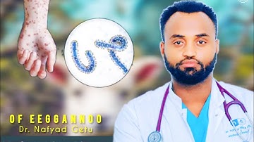 Dr.Nafyad Getu | Of Eeggannoo haa goonu  | Dhukkuba Haaraa |