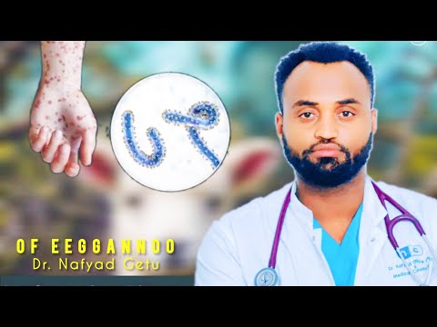 Dr Nafyad Getu Of Eeggannoo Haa Goonu Dhukkuba Haaraa