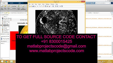 Matlab code for Automatic Detection of Retinal Lesions for Screening of Diabetic Retinopathy