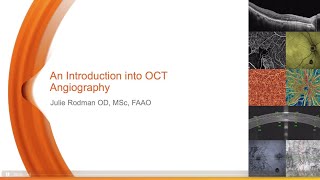 Introduction to OCT Angiography