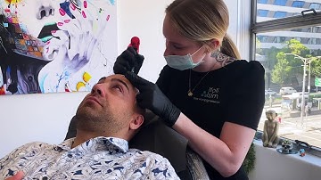 Is Scalp Micropigmentation (SMP) Painful? | Foli Sim SMP | Pt 2.