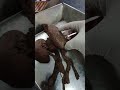 Gross Anatomy of the Kidneys