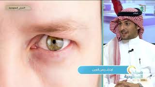 أسباب وأعراض ارتخاء جفن العين وطرق علاجه.. مع د. محمد السماري.