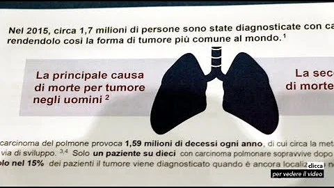 Quanti stadi ha il tumore al polmone?