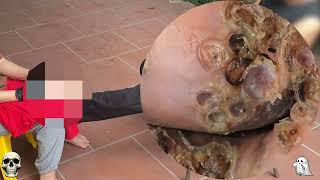 Extreme Jigger Infestation – Unexpected Deep Tissue Impact! #GF389