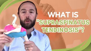 What Is Supraspinatus Tendinosis? Shoulder Pain