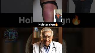 Holster Sign| Best app for NEET PG Preparation |Dopamine|