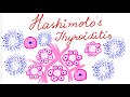 HASHIMOTO’S THYROIDITIS - MICROSCOPY