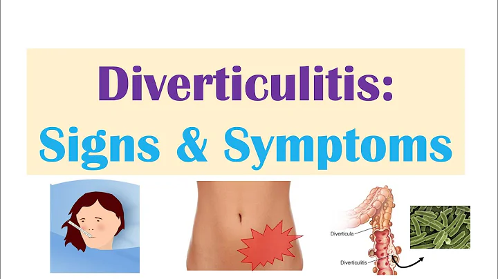 Diverticulitis Signs & Symptoms (And Why They Occur) - DayDayNews