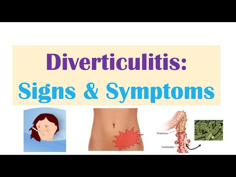 Video: Kan diverticulitis pijn uitstralen naar de rug?