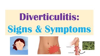 Diverticulitis Signs & Symptoms (And Why They Occur) screenshot 5