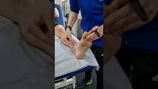 Bony landmarks of the ankle
