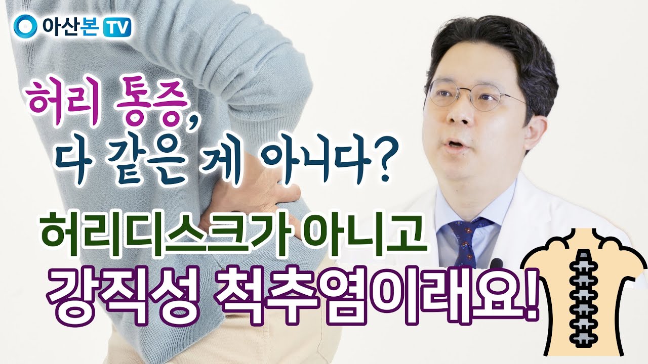 류마티스내과 의학정보 - 허리디스크가 아니고 강직성 척추염?