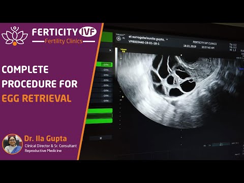 Complete procedure for egg retrieval