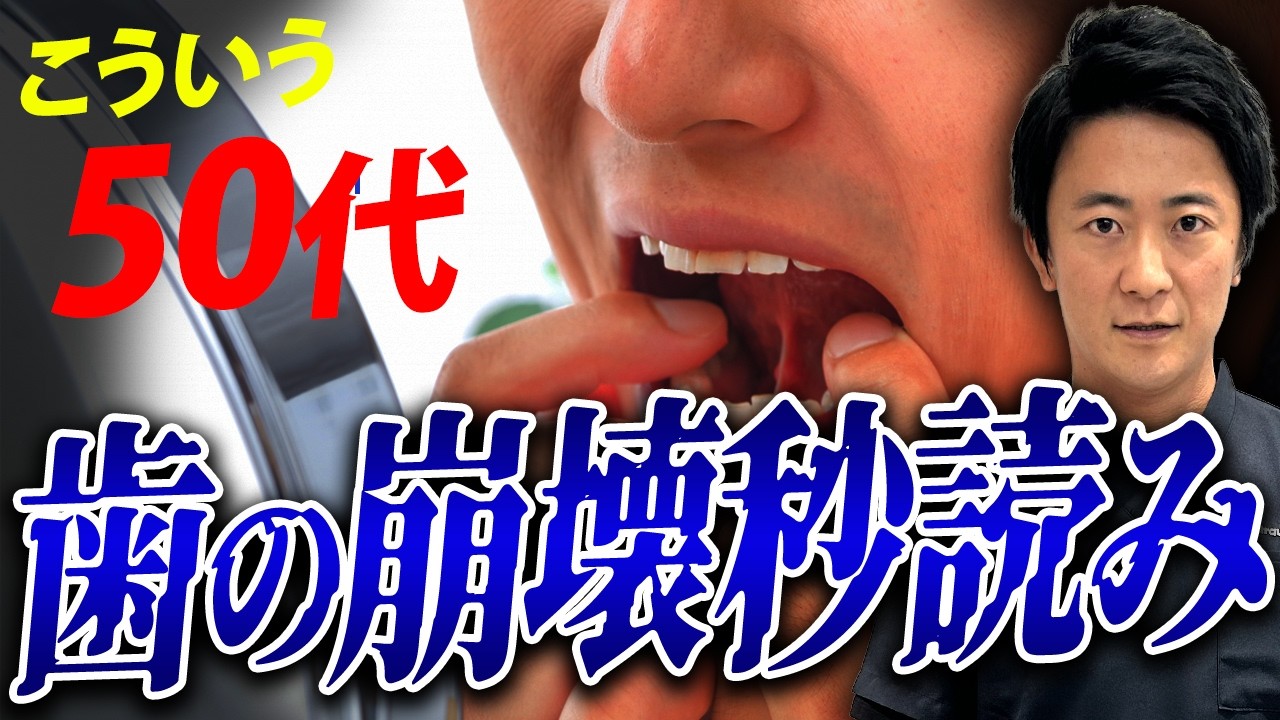 ONE PIECE 一部歯抜け 歯科医が警告】1本の欠損が命取り！歯抜け連鎖で口腔内崩壊します