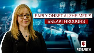 Making breakthroughs in Alzheimer s research