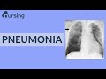 Pneumonia (Nursing School Lessons)