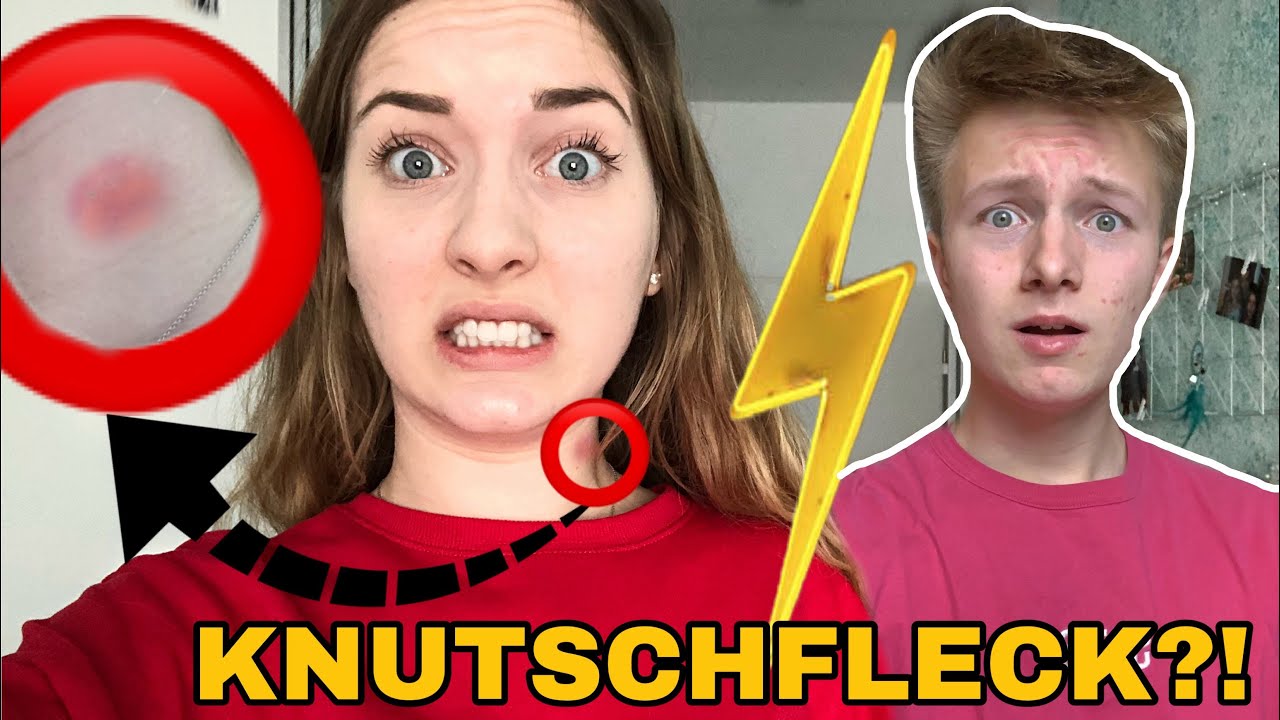 KNUTSCHFLECK Prank an FREUND 😨💋 maryland board of nursing