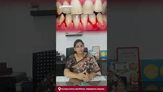 Why Do My Gums Bleed When I Floss? 2 Main Reasons Explained!